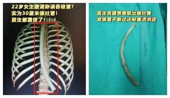 beat365那些把50cm仙女管塞入体内的女孩是自虐上瘾吗？(图2)